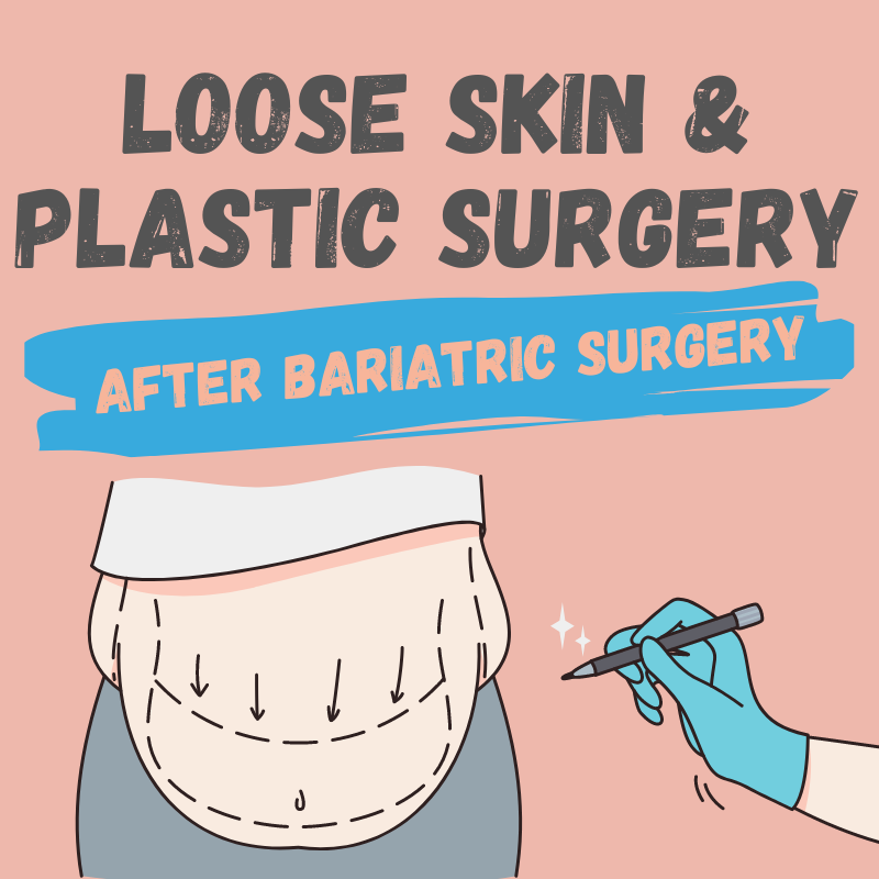 Plastic Surgery After Gastric Bypass Surgery