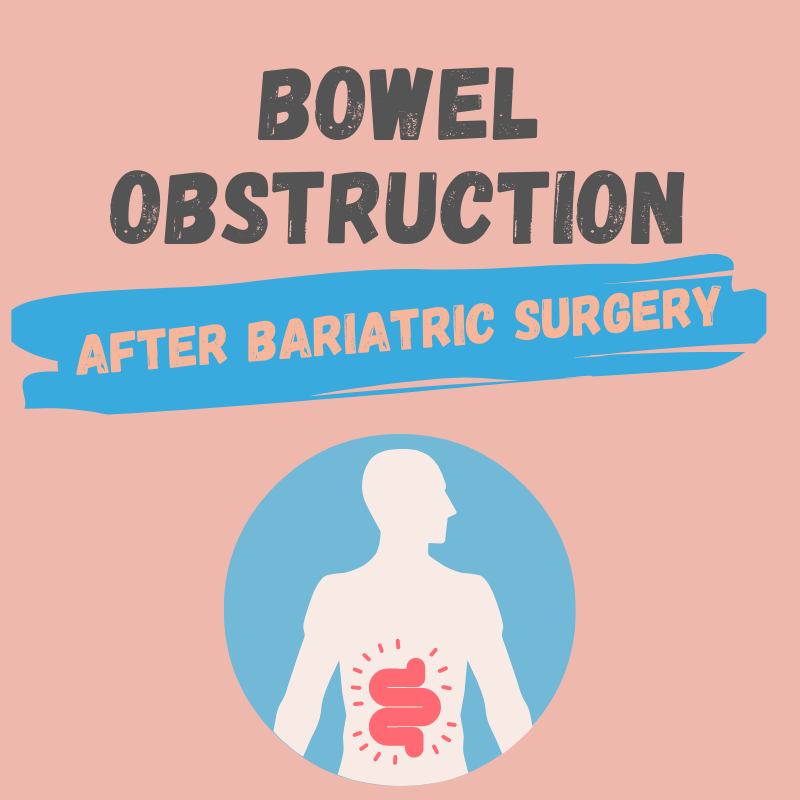 Bowel Obstruction After Bariatric Surgery