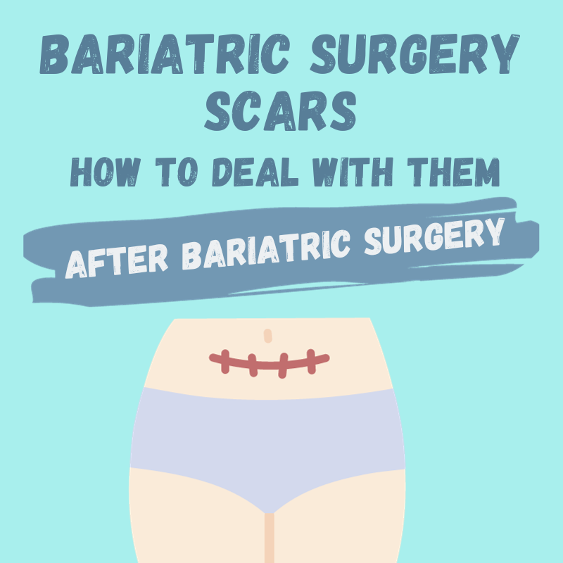 how to deal with bariatric surgery scars