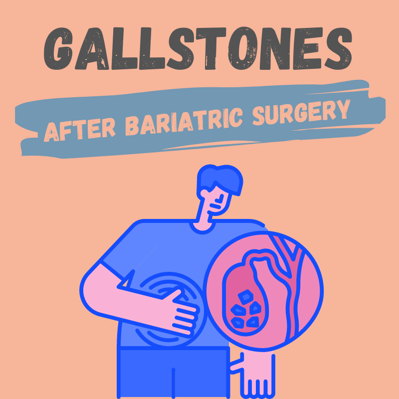 gallstones after bariatric surgery