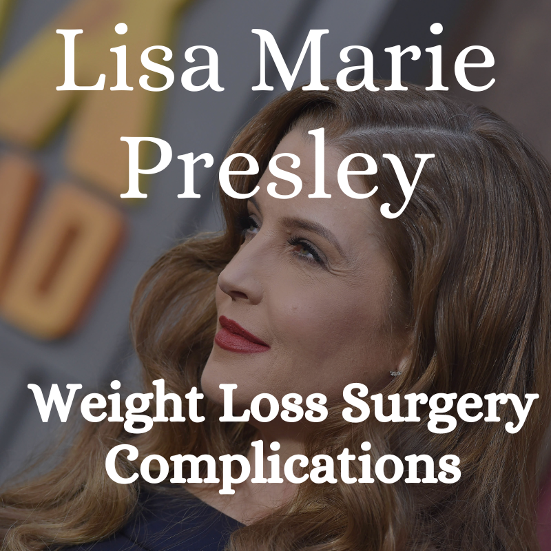 lisa marie presley weight loss surgery complications