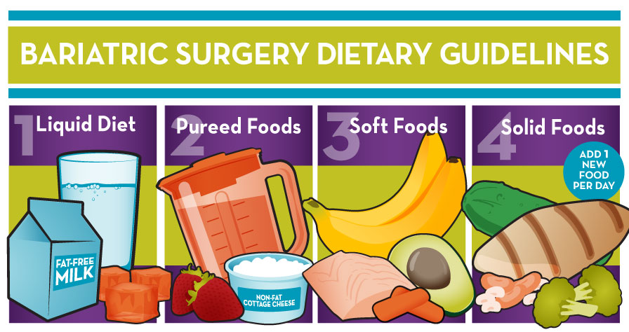 Bariatric Diet Phases After Surgery