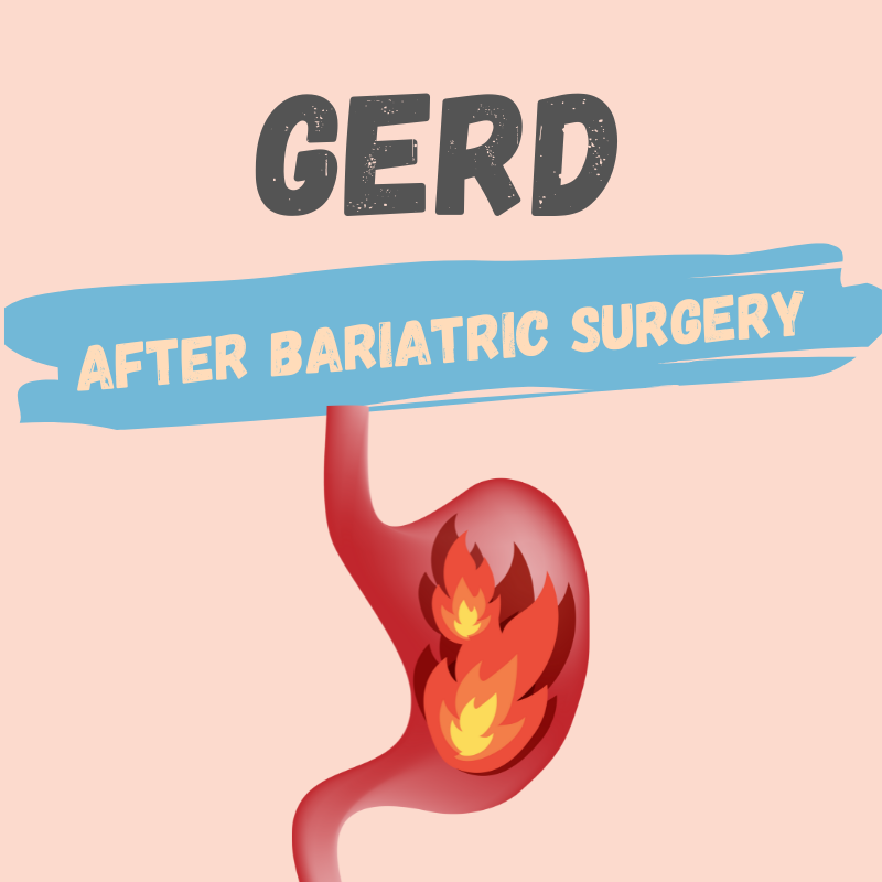 GERD after bariatric surgery