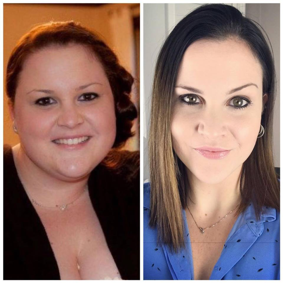 5+ Years Post-Op Gastric Sleeve - This Is My Story!