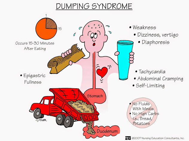 Surviving Dumping Syndrome