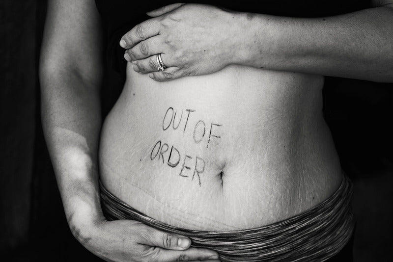 Bariatrics Dumping Syndrome