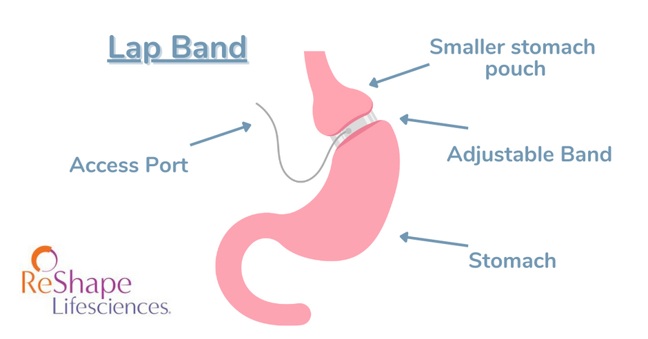 8 Bariatric Soft Food Recipes - Quick & Simple – Bariatric Food Source