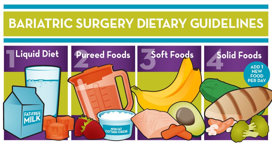 A Guide to a Bariatric Diet After Gastric Bypass Surgery